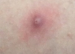 KLAXON - What is this - a spot or something else? Sporny pic included