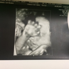 July 2016 Babies (8) - 3rd trimester here we come