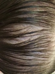 AIBU to expect hair to grow on my head! PICS