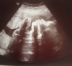 August 2016 number 5 - waddling towards the third trimester!