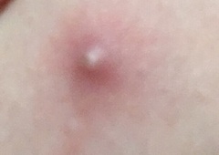 KLAXON - What is this - a spot or something else? Sporny pic included