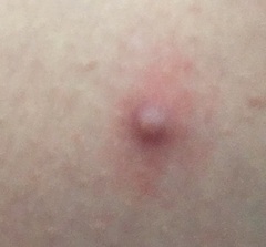 KLAXON - What is this - a spot or something else? Sporny pic included