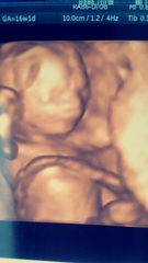 October 2016 (thread number four). Entering the second trimester.