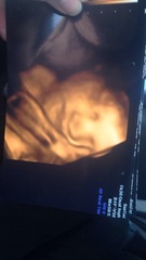 July 2016 Babies (8) - 3rd trimester here we come