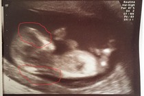 Could it be twins? Help needed please :)