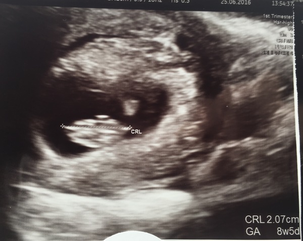 Due in February 2017...thread #2!