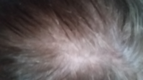 to ask you if this looks normal and show me yours
