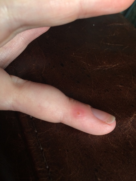 To magsulph or not to magsulph?