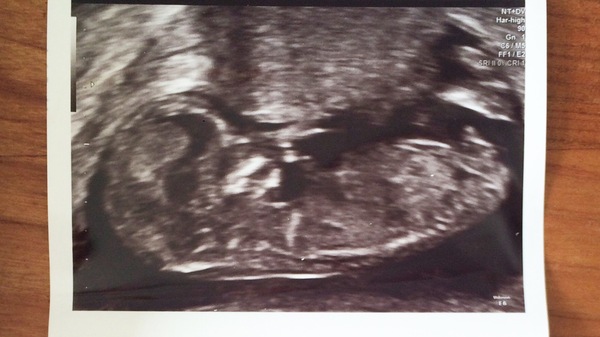 December 2016 babies... 2nd trimester in sight