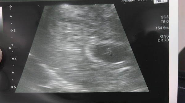 Due in February 2017...thread #2!