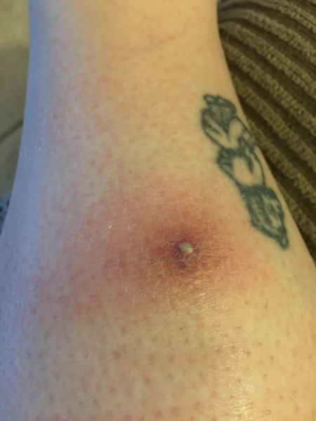 KLAXON!  it's delightfully disgusting!