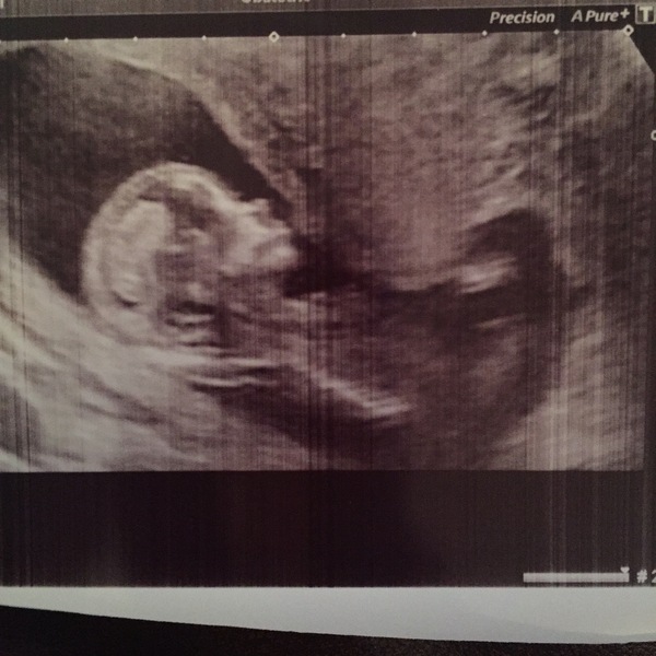 Thread #8 - TTC#1 Grads - stripy bump photos ahoy!