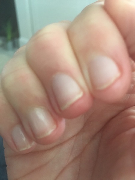 Really need the ultimate nail help plan