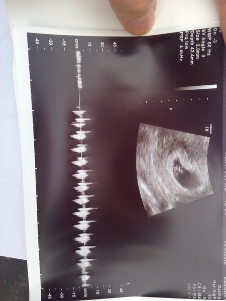 Thread #8 - TTC#1 Grads - stripy bump photos ahoy!