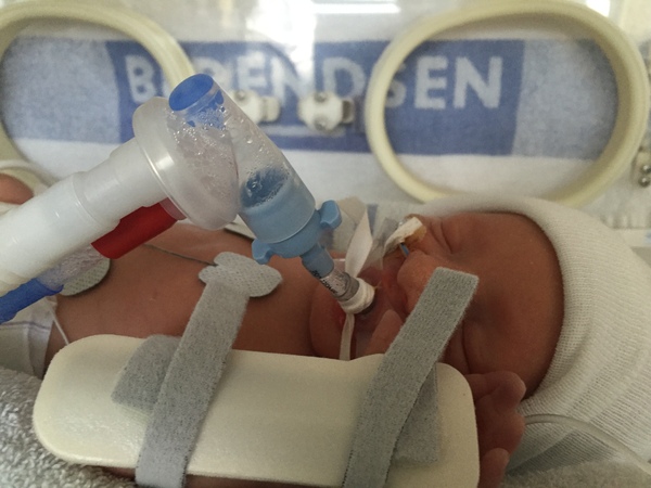 July 2016 Babies (9) - let the babies commence!