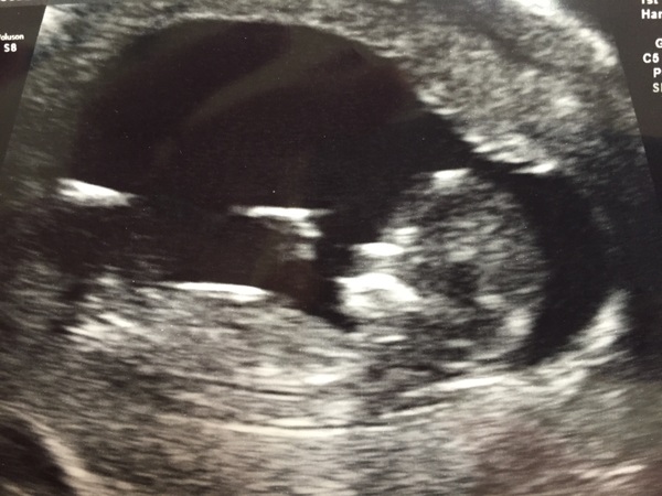 December 2016 babies... 2nd trimester in sight