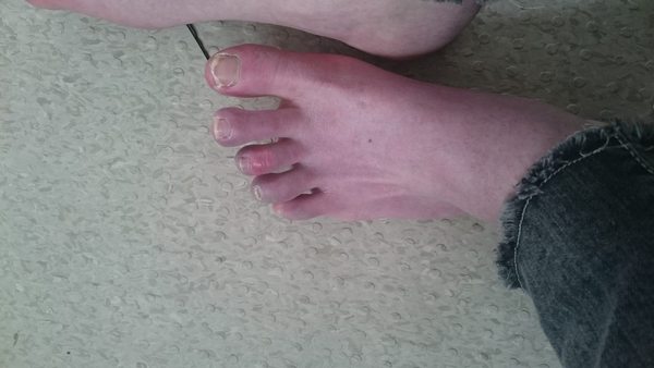 What is up with my feet? (photo)