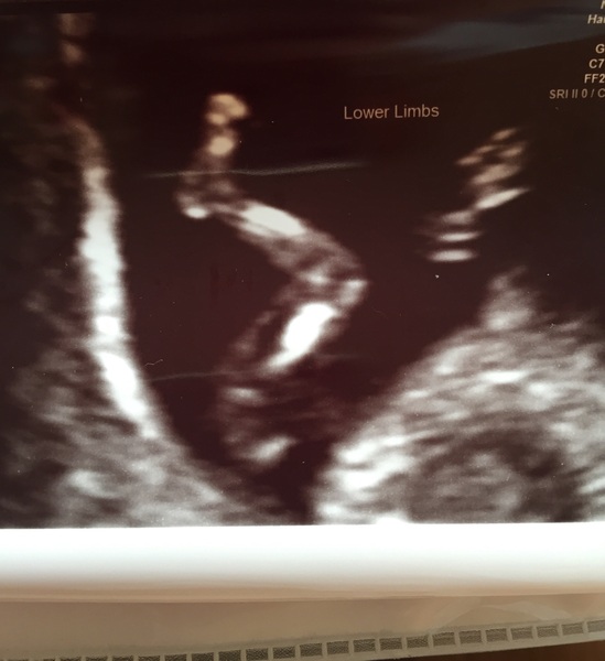 December 2016 babies... 2nd trimester in sight