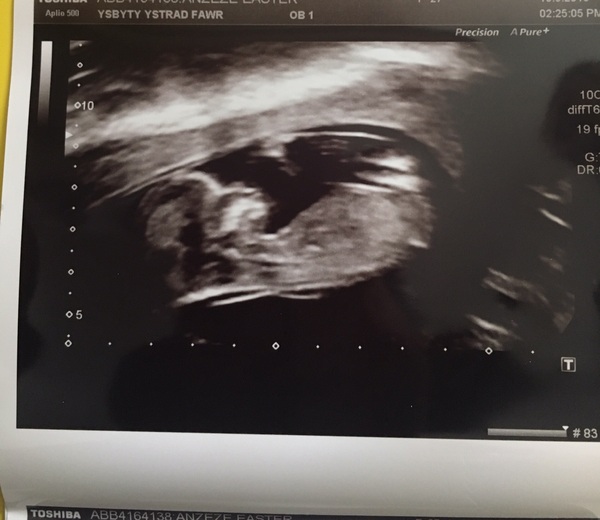 Late December - Early January '17 Babies