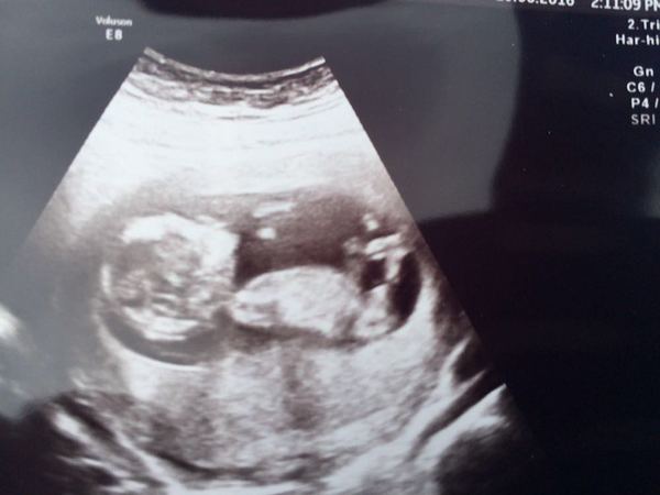 December 2016 babies... 2nd trimester in sight