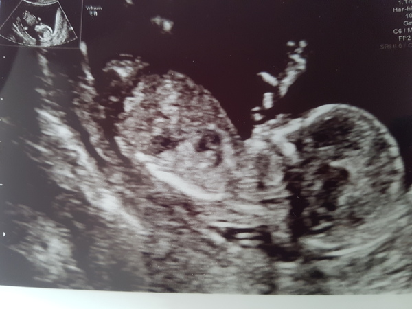 December 2016 babies... 2nd trimester in sight