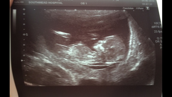 December 2016 babies... 2nd trimester in sight