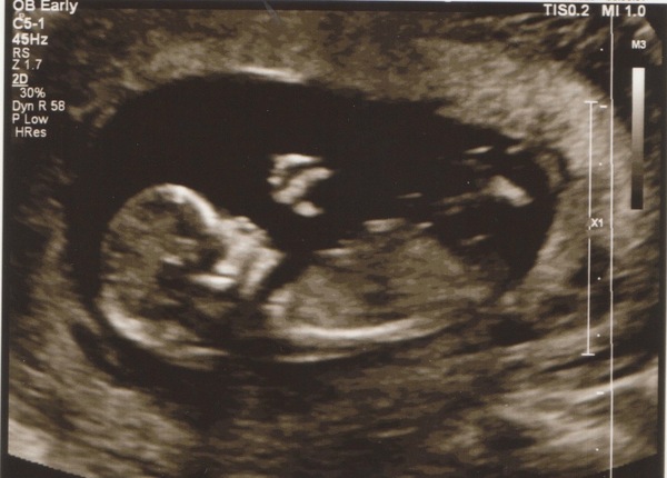 December 2016 babies... 2nd trimester in sight