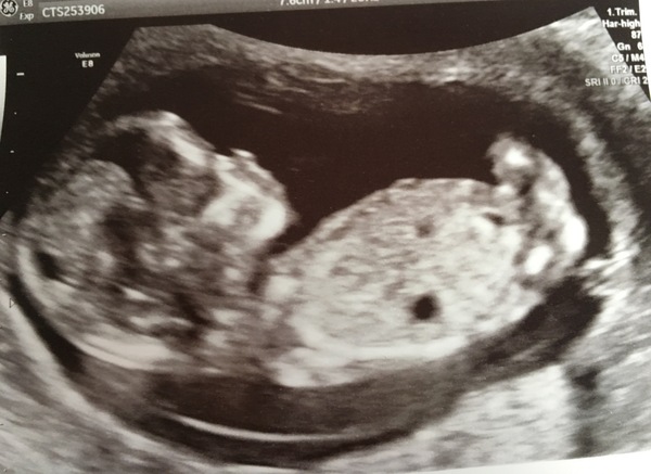 Late December - Early January '17 Babies