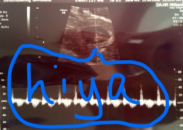 Due in February 2017...thread #2!