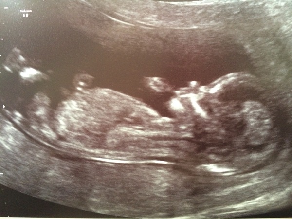 December 2016 babies... 2nd trimester in sight