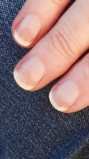 Can you have a look at my weird nails please