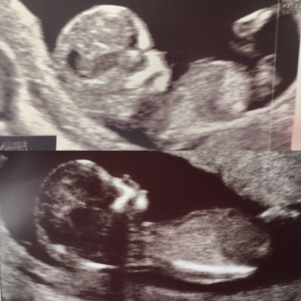 December 2016 babies... 2nd trimester in sight