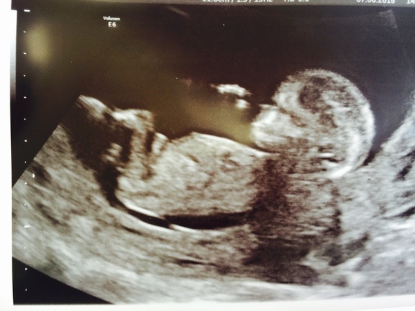 December 2016 babies... 2nd trimester in sight