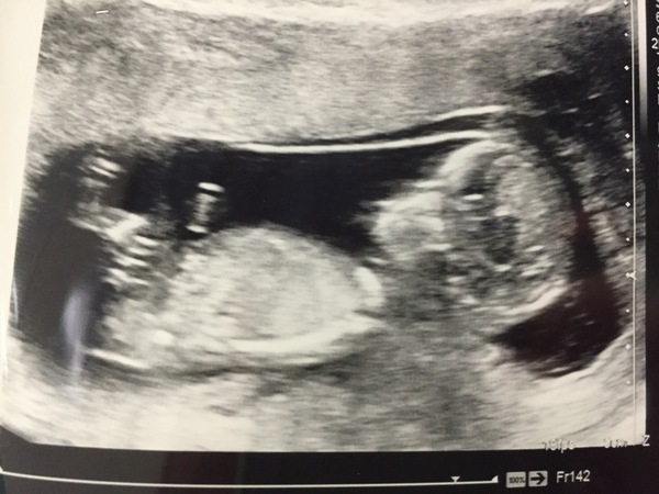 December 2016 babies... 2nd trimester in sight