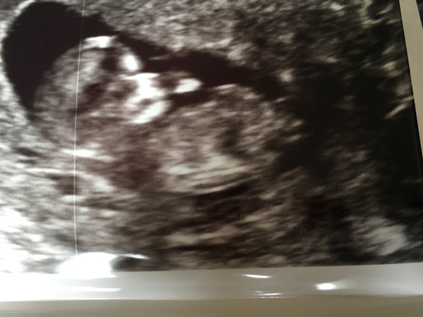 December 2016 babies... 2nd trimester in sight