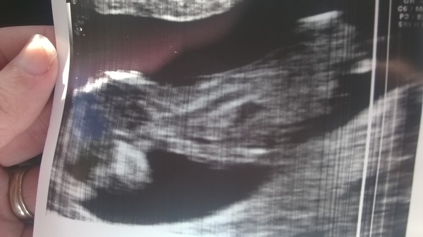 Staying posifrickentive- Thread 9 for ladies pg after mc