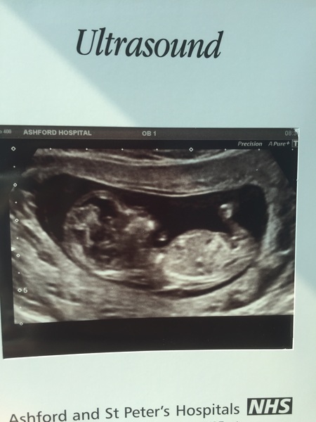 December 2016 babies... 2nd trimester in sight