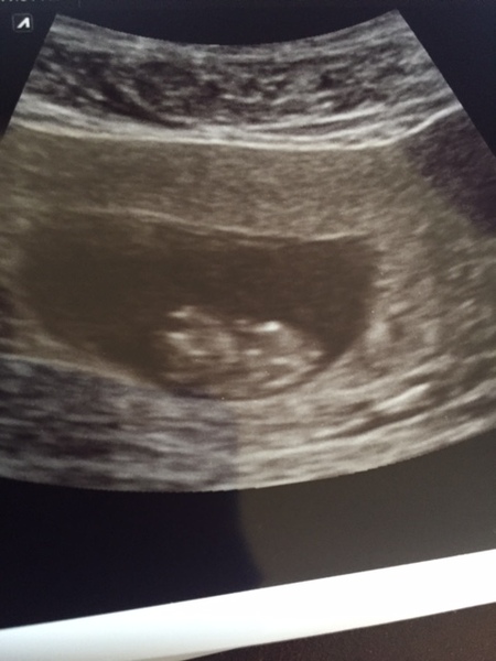 Thread #7 - TTC#1 Grads - Third Trimester Special