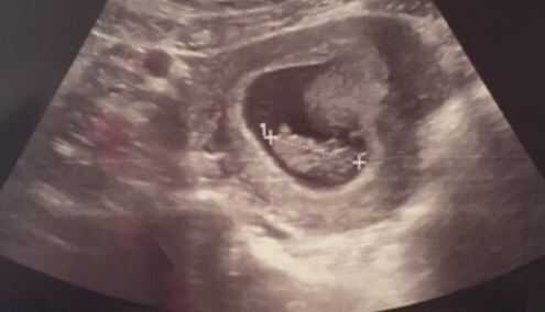 Late December - Early January '17 Babies