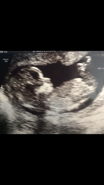 August 2016 number 5 - waddling towards the third trimester!