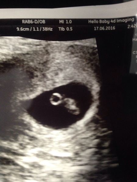 Due in February 2017...thread #2!