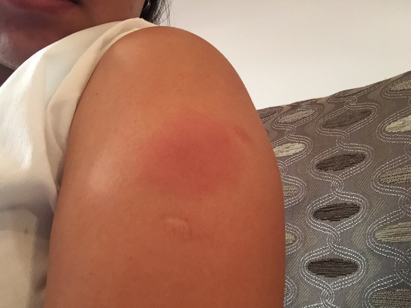 August 2016 number 5 - waddling towards the third trimester!