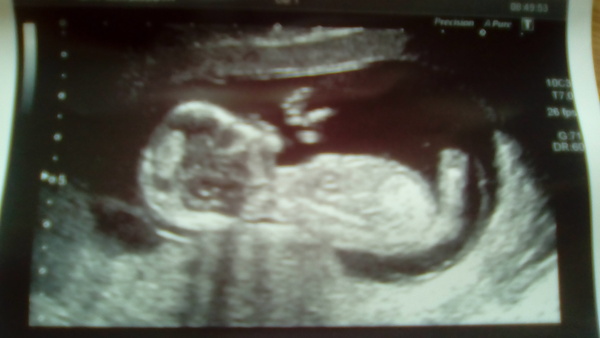 December 2016 babies... 2nd trimester in sight