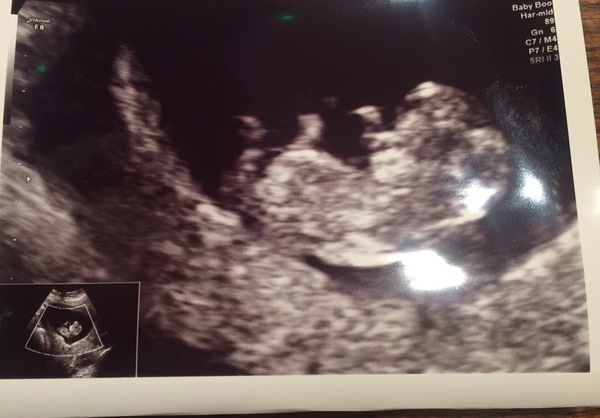December 2016 babies... 2nd trimester in sight
