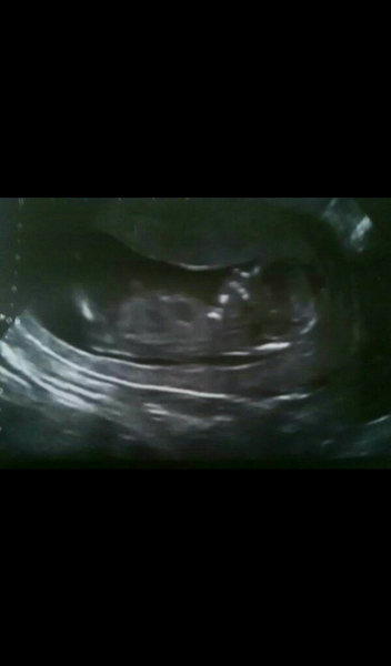 Skull theory, boy or girl?
