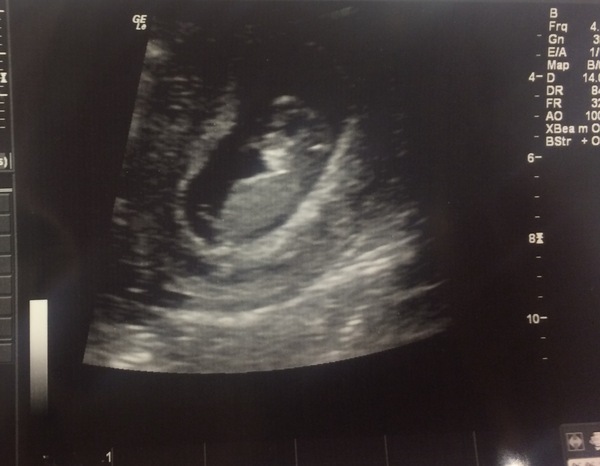 December 2016 babies... 2nd trimester in sight