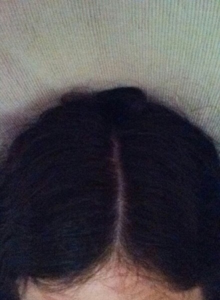 to ask you if this looks normal and show me yours