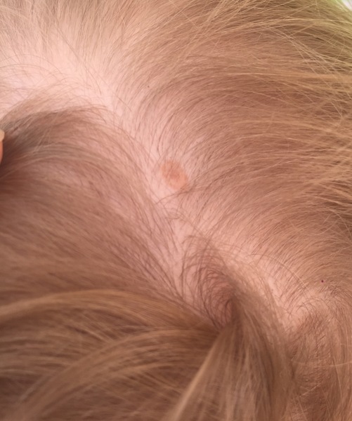 Any idea what this is on DS's head? (Photo)