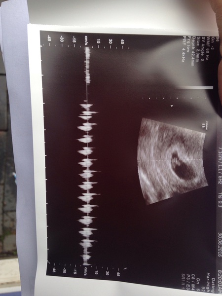 Due in February 2017...thread #3!