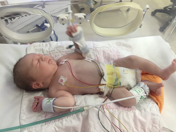 July 2016 Babies (9) - let the babies commence!